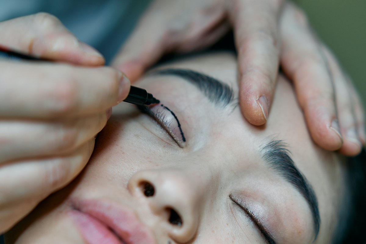 blepharoplastie