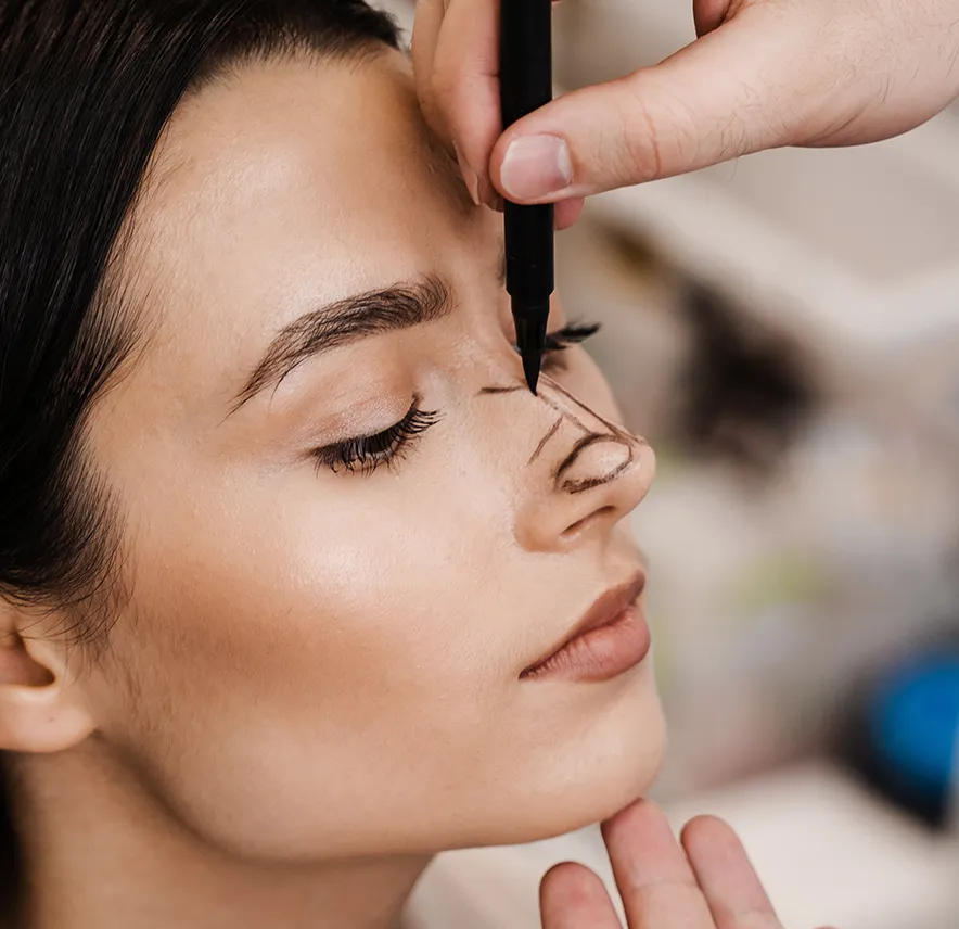 Rhinoplastie