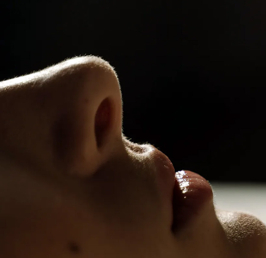 Rhinoplastie médicale