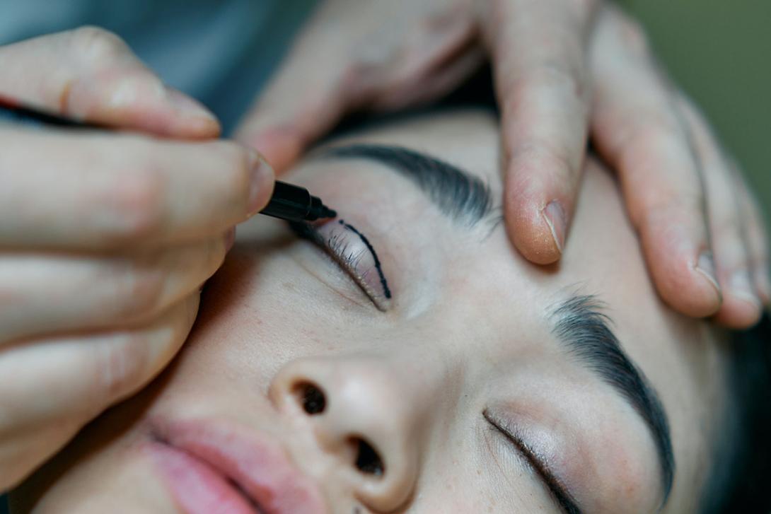 blepharoplastie