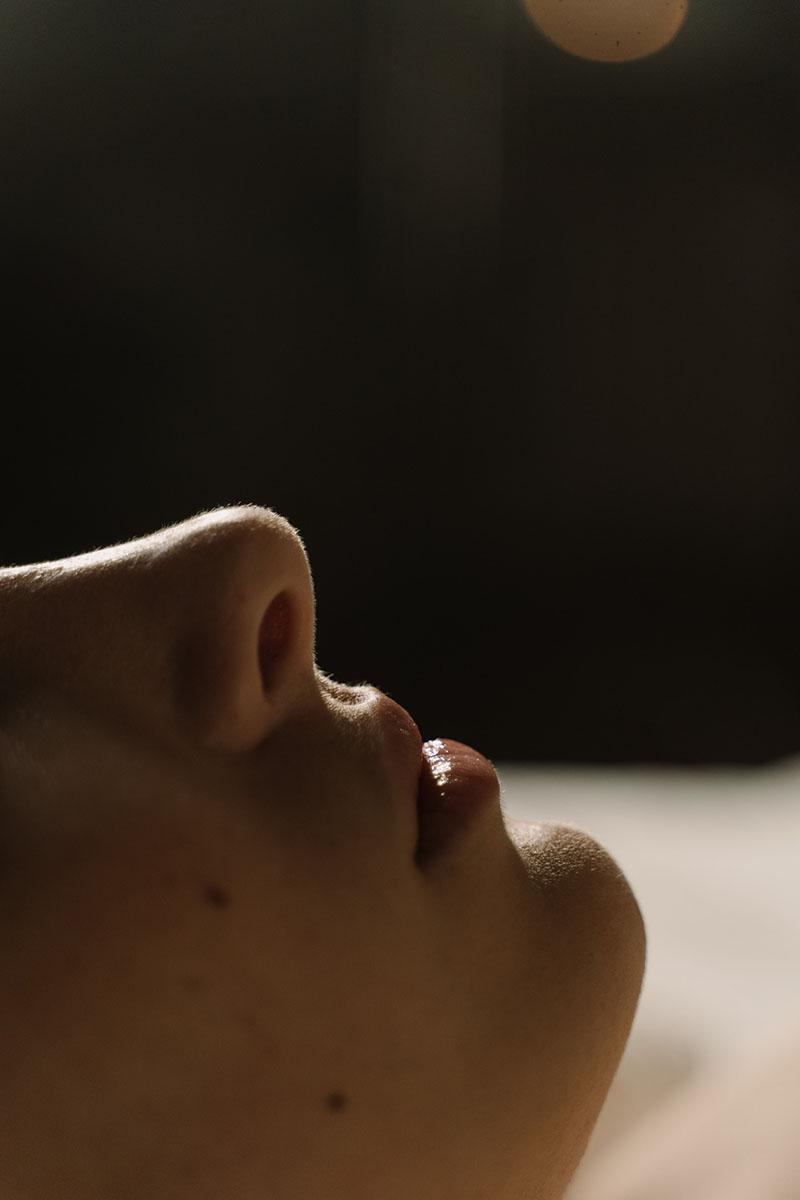 rhinoplastie